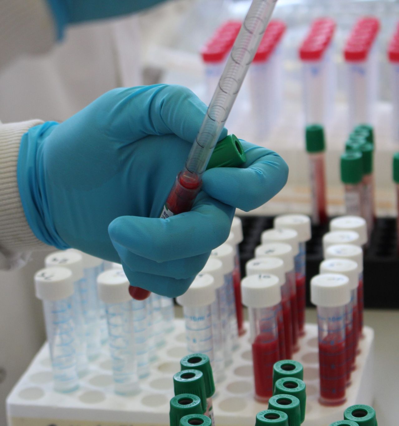 Calls for urgent TB roundtable talks as FFA warns ‘farmers have suffered enough’