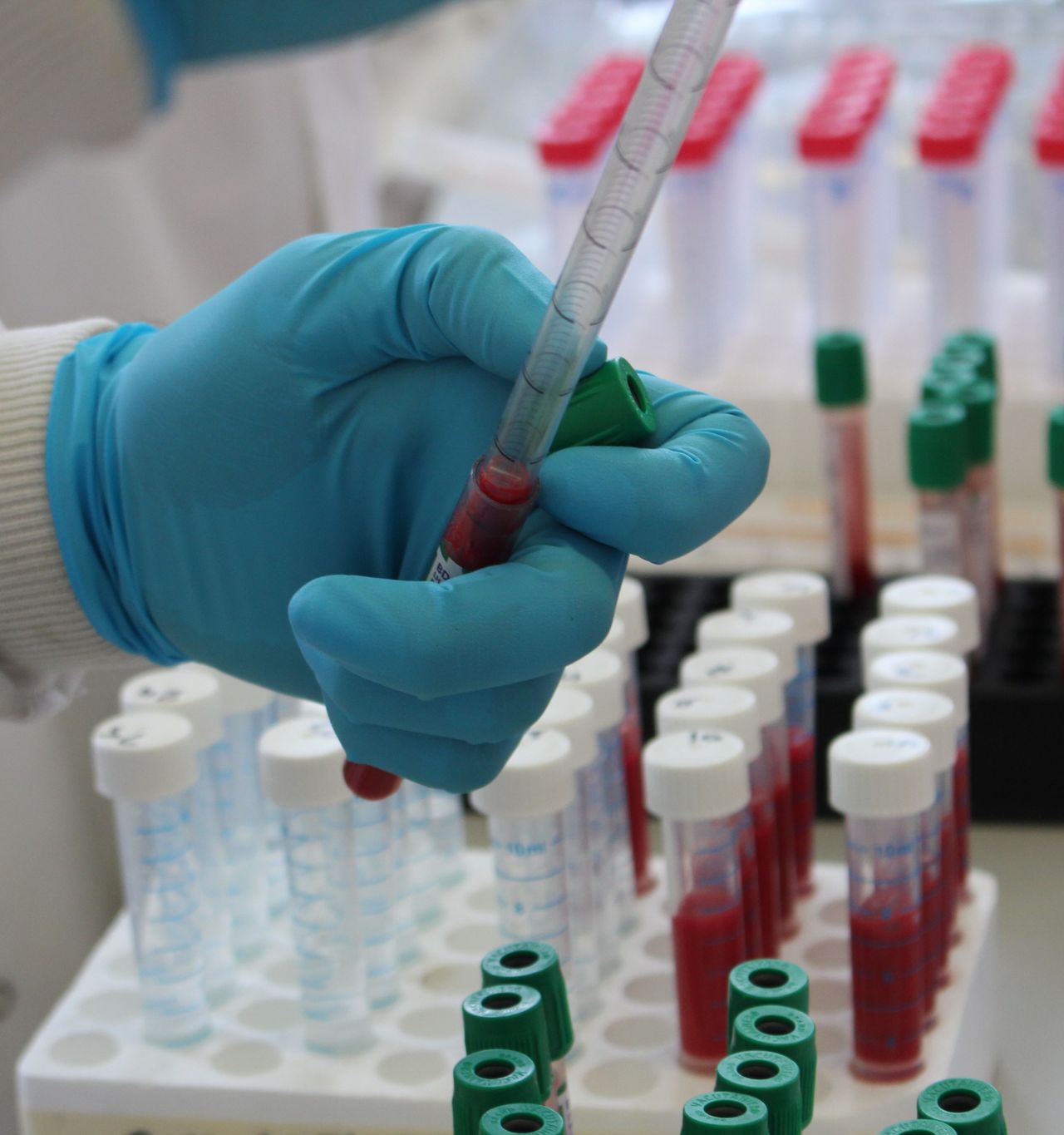 Farmers must debate NI’s bovine TB plans, says UFU