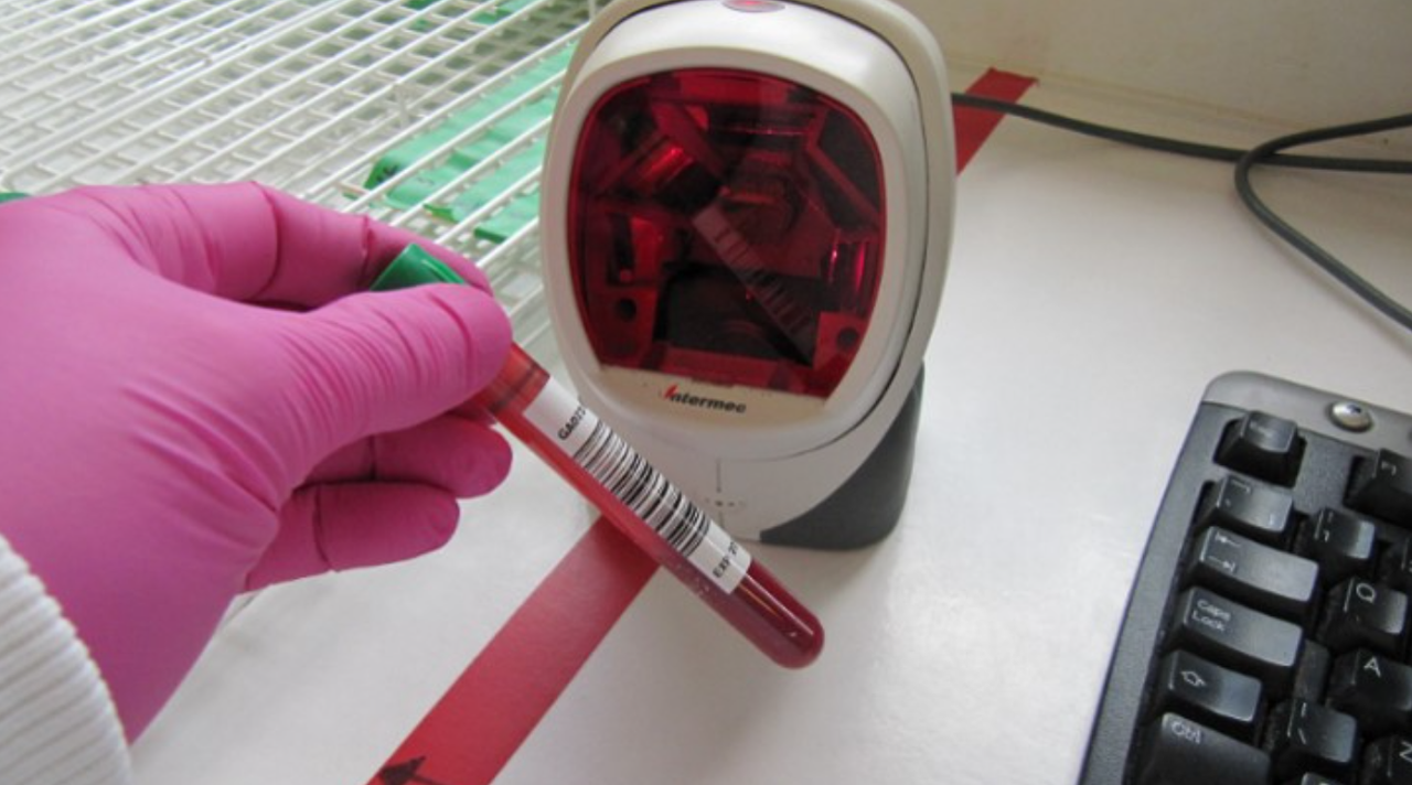 UK government to establish specialist TB interferon-gamma testing lab