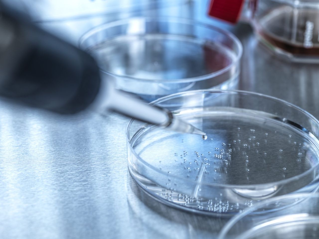 US confirms first human bird flu case without animal contact